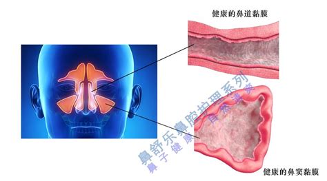 鼻子里面的小肉球是什么，功能／结构／异常情况